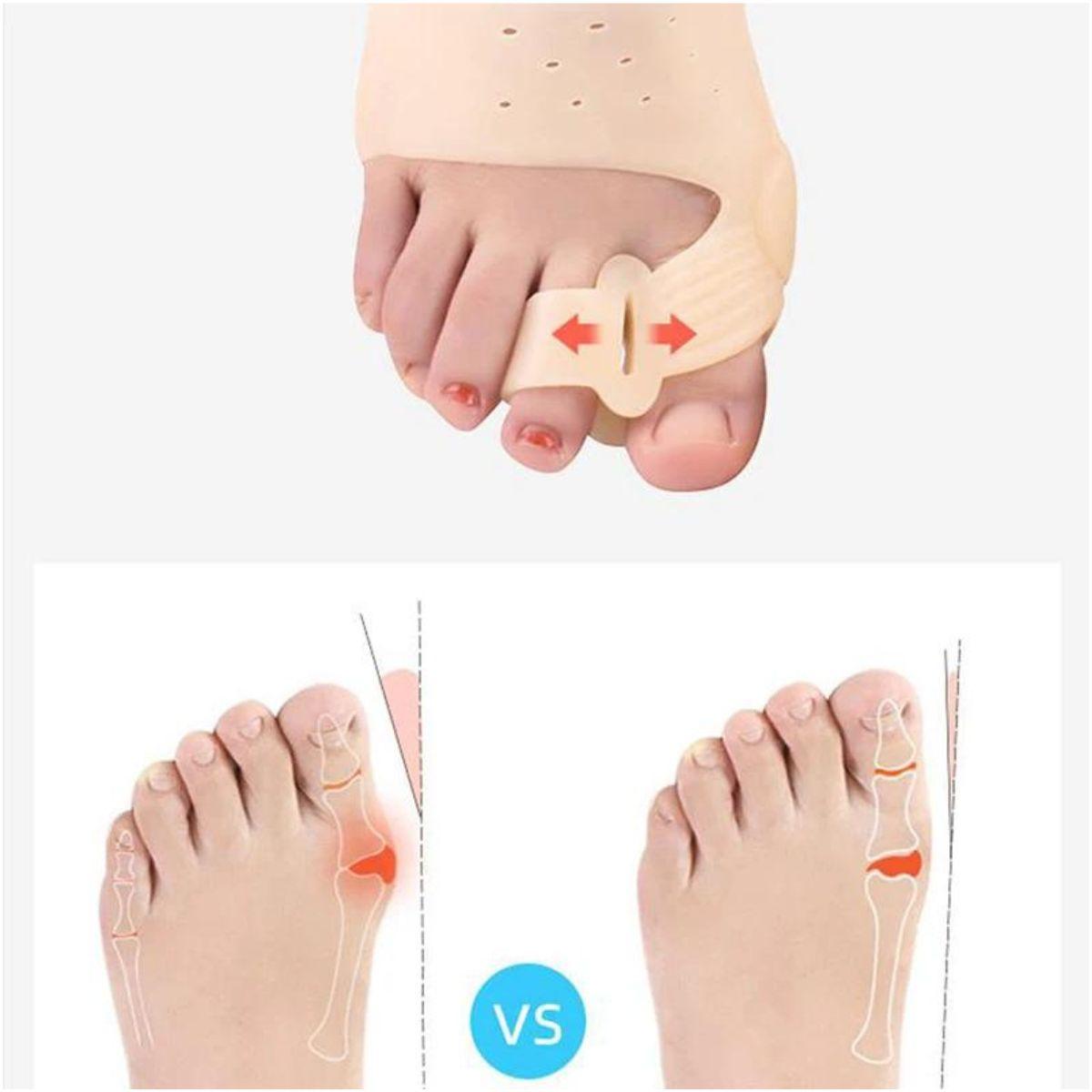 Ortho Toe Corrector - tcistarhealthproducts